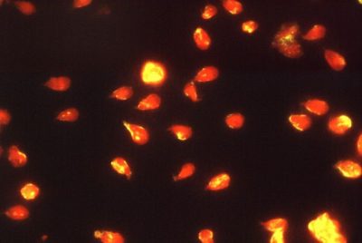 giardia-lamblia-parasites-using-an-indirect-immunofluorescence-test-725x485